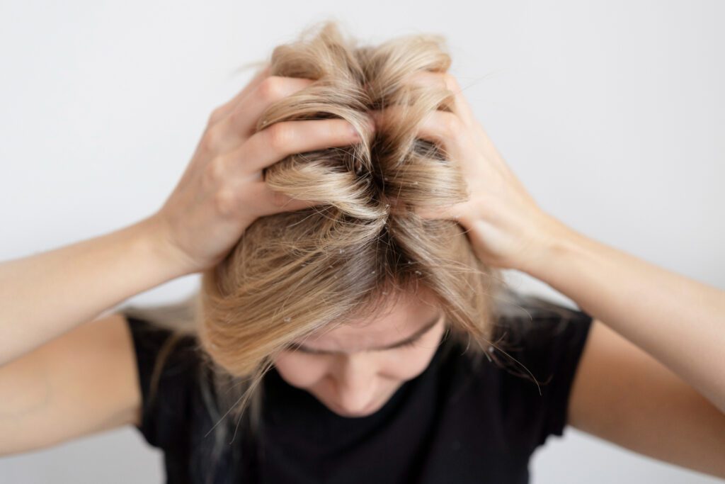 Cuir chevelu qui gratte : pourquoi ça démange et comment le laver sans l'agresser ? Image Freepik - Magnific.com